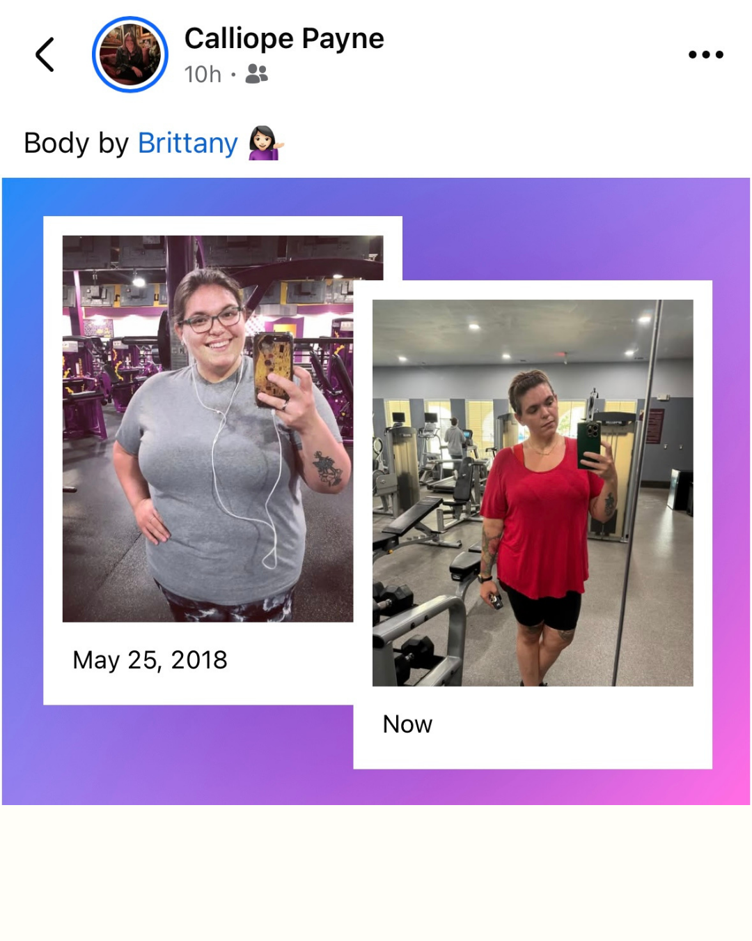 Before and after weight loss -- Calliope lost 130+ lbs with medically supervised semaglutide program at Happy Drip