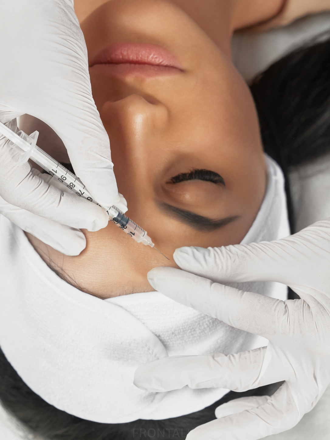 Forehead lines neurotoxin treatment