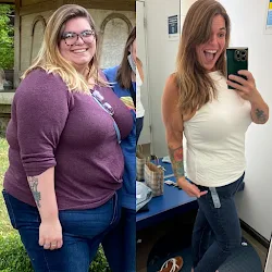 Semaglutide before and after weight loss results -- Happy Drip IV & Wellness patient, 130+ lbs lost