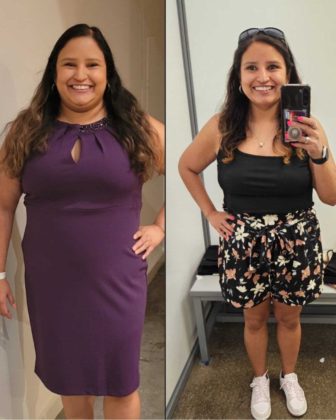 Tirzepatide weight loss before and after -- Happy Drip patient Kristine lost 50 lbs