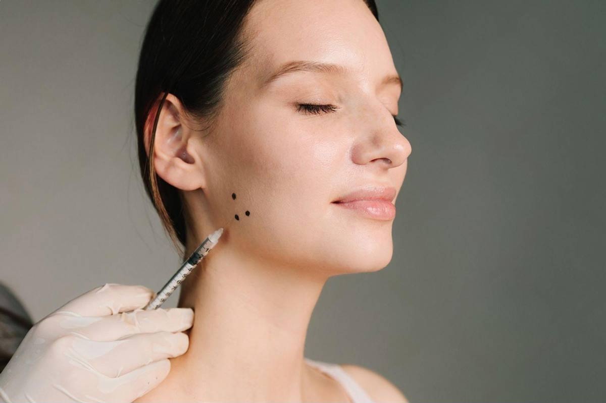 Jawline masseter neurotoxin slimming treatment