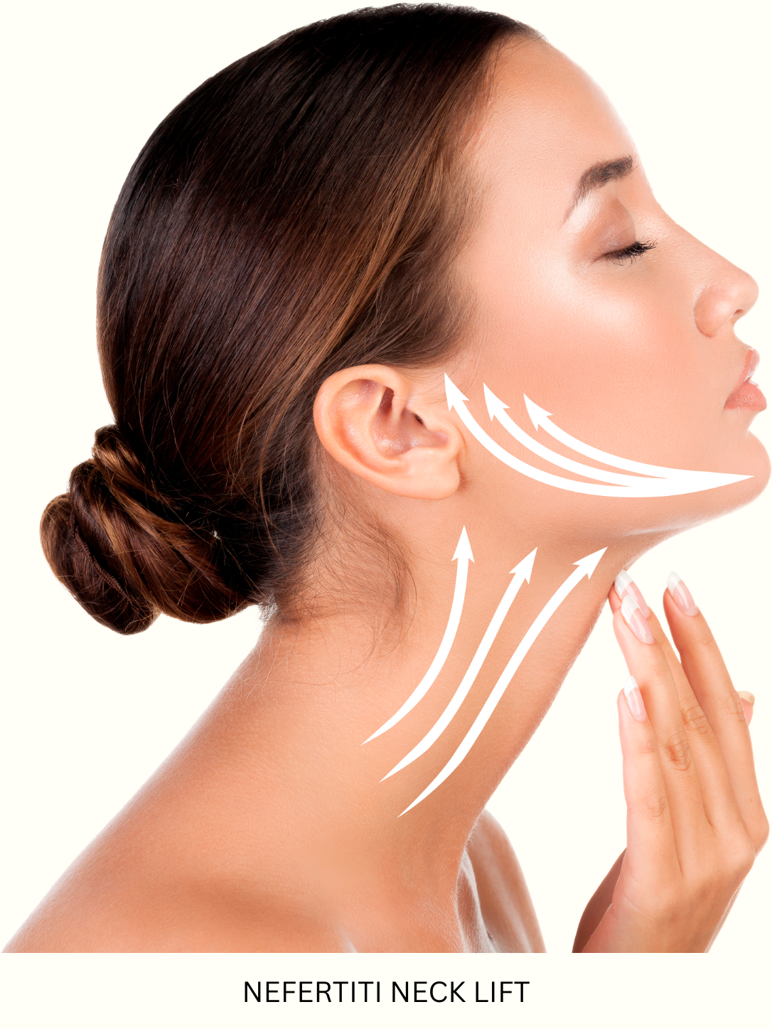 Nefertiti neck lift neurotoxin treatment