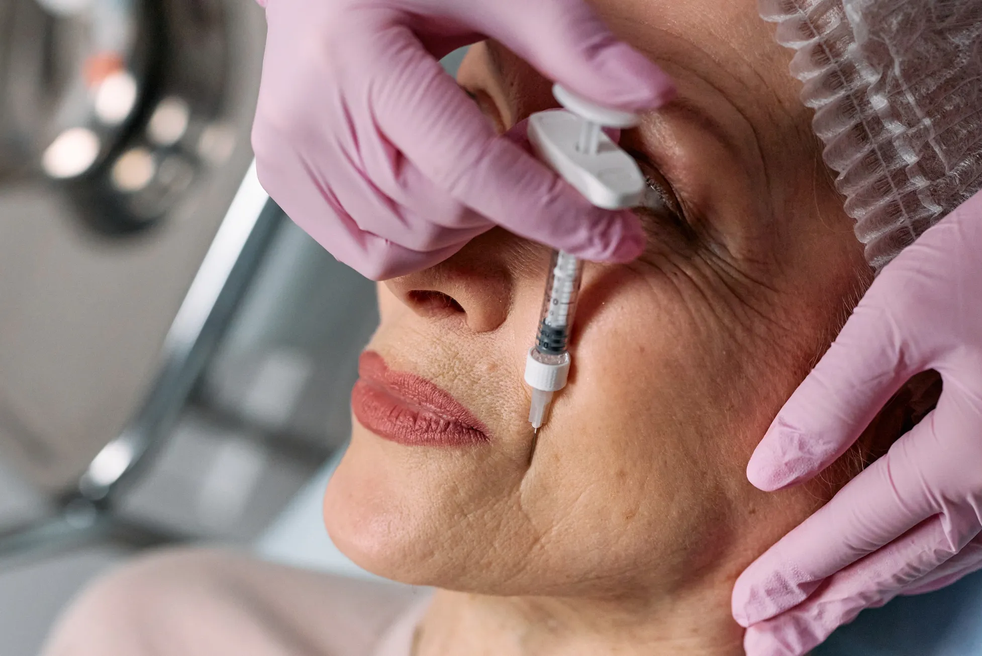 Nefertiti neck lift neurotoxin treatment